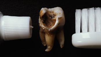Tooth Decay Prevention: Achieving a Healthier Smile with Fluoride-Free Toothpaste and Electric Toothbrushes - Polr. Care